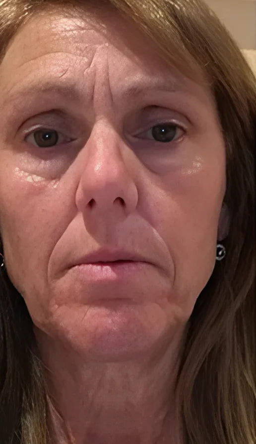 Anti-wrinkle and anti-aging cream, hyaluronic acid moisturizer firms and lifts to reduce wrinkles and crow's feet.